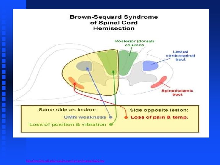 http: //medinfo. ufl. edu/year 2/neuro/review/images/fig 02. jpg 