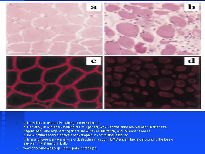 n n a. Hematoxylin and eosin staining of control tissue b. Hematoxylin and eosin