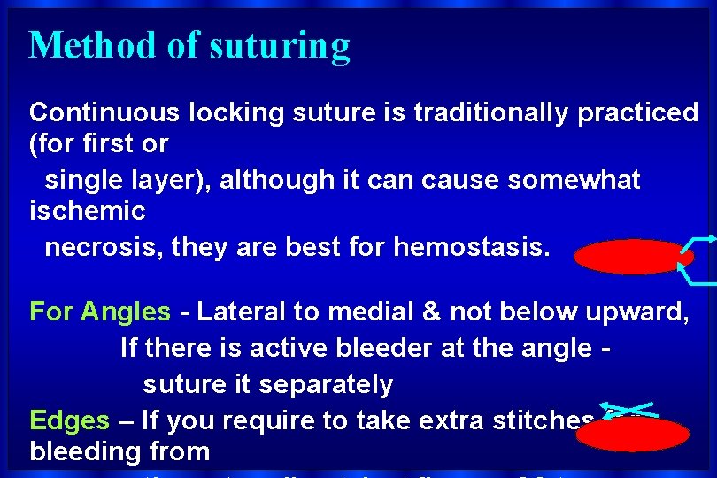 Method of suturing Continuous locking suture is traditionally practiced (for first or single layer),