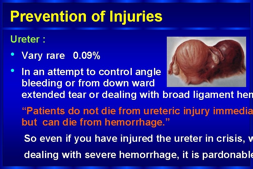Prevention of Injuries Ureter : • • Vary rare 0. 09% In an attempt