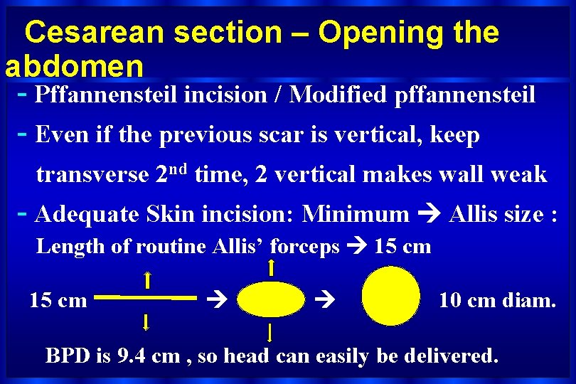 Cesarean section – Opening the abdomen - Pffannensteil incision / Modified pffannensteil - Even