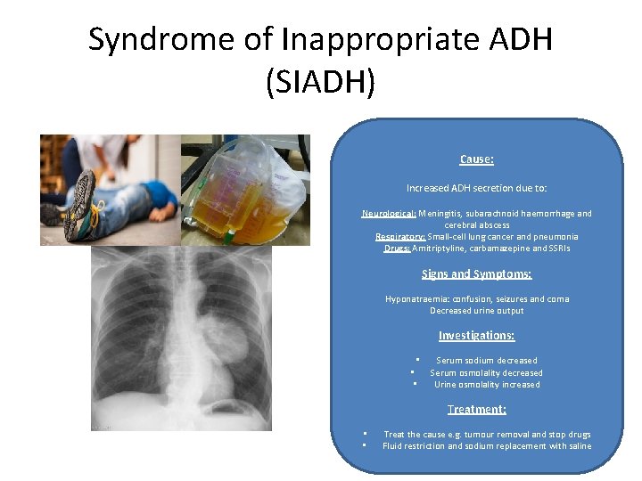 Syndrome of Inappropriate ADH (SIADH) Cause: Increased ADH secretion due to: Neurological: Meningitis, subarachnoid