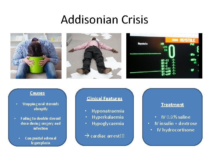 Addisonian Crisis Causes Stopping oral steroids abruptly • Failing to double steroid dose during