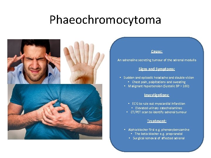 Phaeochromocytoma Cause: An adrenaline secreting tumour of the adrenal medulla Signs and Symptoms: •
