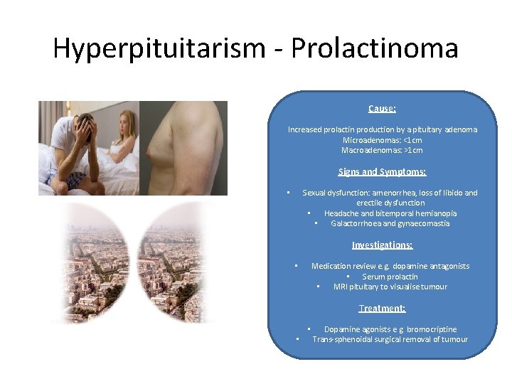 Hyperpituitarism - Prolactinoma Cause: Increased prolactin production by a pituitary adenoma Microadenomas: <1 cm