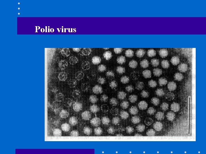 Polio virus 