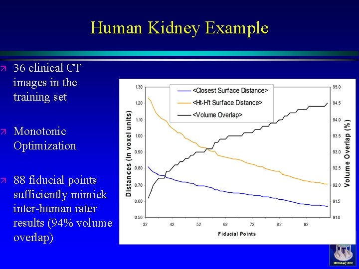 Human Kidney Example ä 36 clinical CT images in the training set ä Monotonic