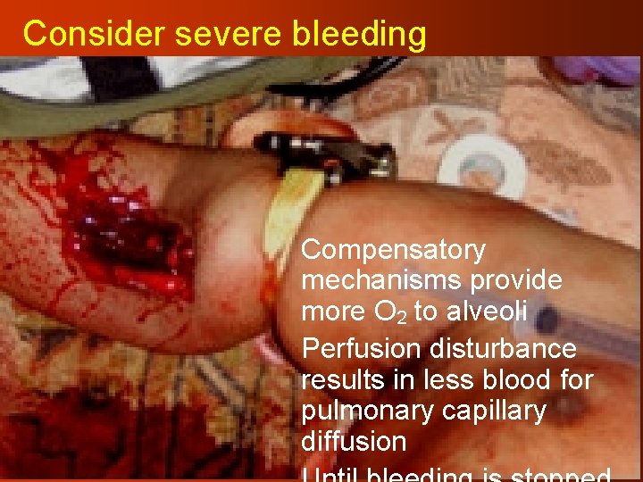 Consider severe bleeding Compensatory mechanisms provide more O 2 to alveoli Perfusion disturbance results
