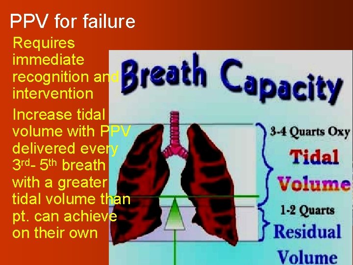 PPV for failure Requires immediate recognition and intervention Increase tidal volume with PPV delivered