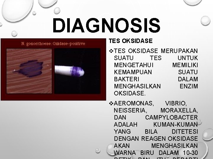 DIAGNOSIS TES OKSIDASE v. TES OKSIDASE MERUPAKAN SUATU TES UNTUK MENGETAHUI MEMILIKI KEMAMPUAN SUATU