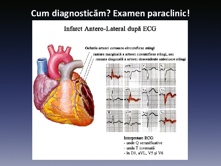 Cum diagnosticăm? Examen paraclinic! 