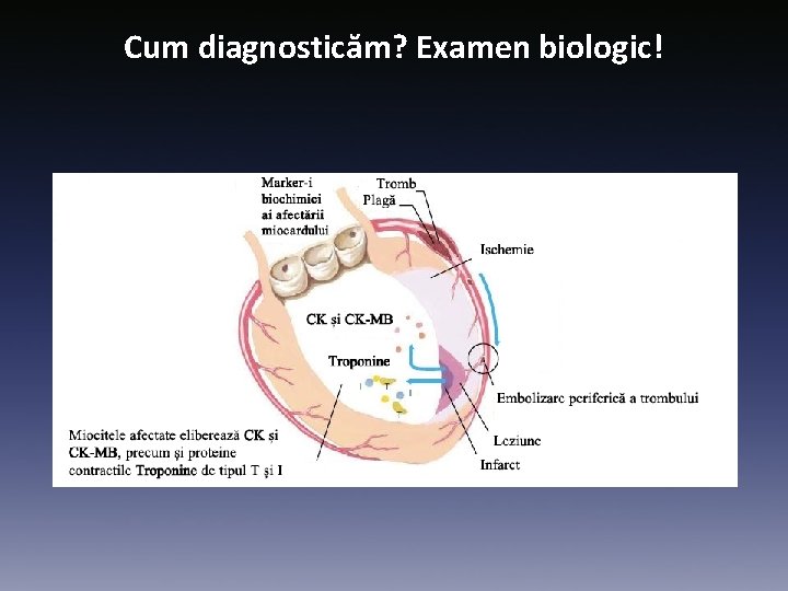 Cum diagnosticăm? Examen biologic! 