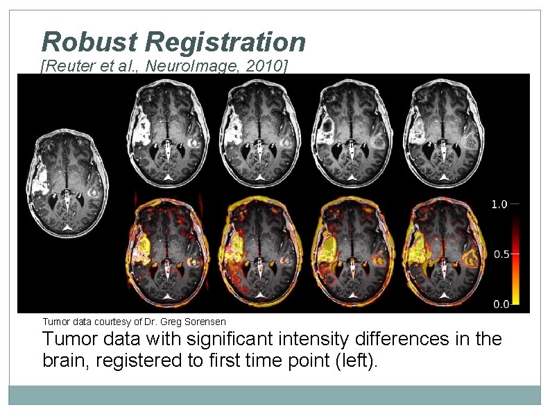 Robust Registration [Reuter et al. , Neuro. Image, 2010] Tumor data courtesy of Dr.