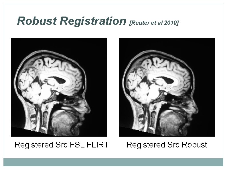 Robust Registration [Reuter et al 2010] Registered Src FSL FLIRT Registered Src Robust 