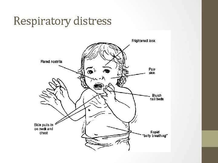 Respiratory distress 