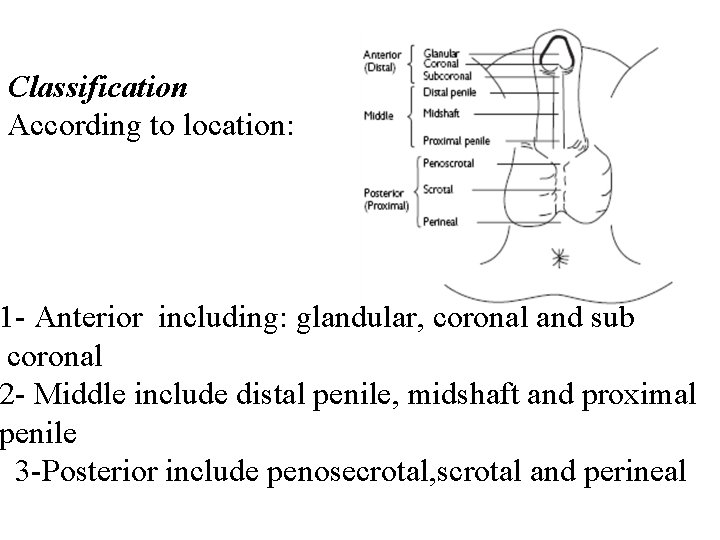 Classification According to location: 1 - Anterior including: glandular, coronal and sub coronal 2