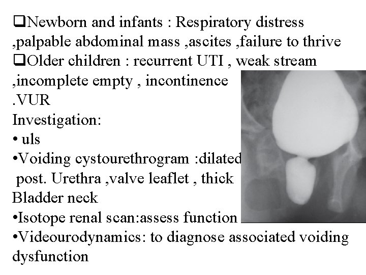 q. Newborn and infants : Respiratory distress , palpable abdominal mass , ascites ,