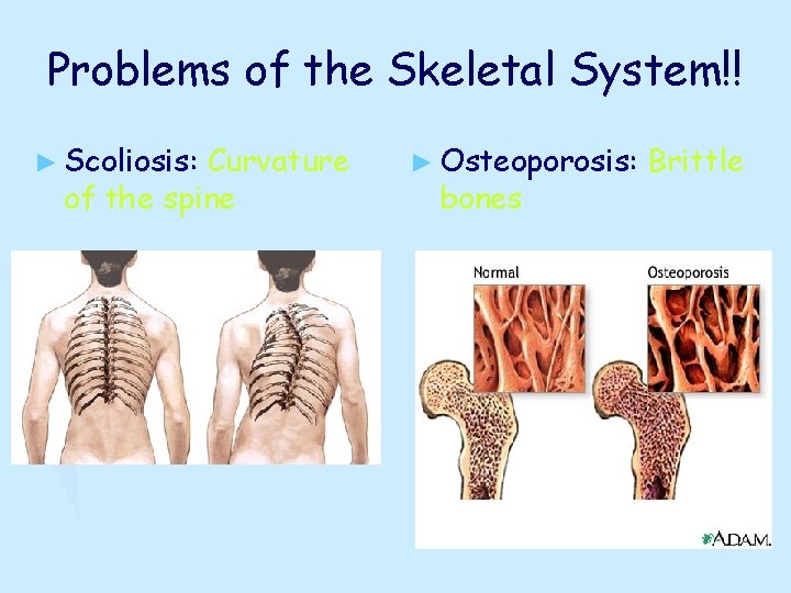 Problems of the Skeletal System!! ► Scoliosis: Curvature of the spine ► Osteoporosis: bones