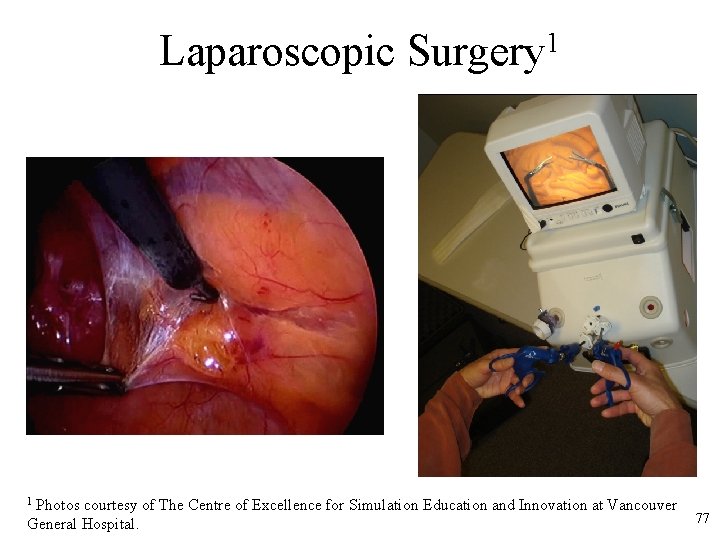 Laparoscopic Surgery 1 Photos courtesy of The Centre of Excellence for Simulation Education and