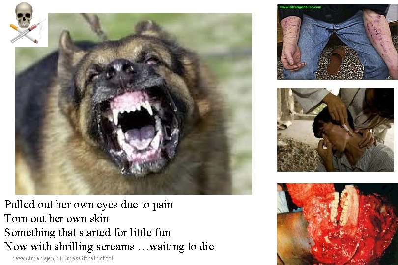 Pulled out her own eyes due to pain Torn out her own skin Something Pulled out her own eyes due to pain Torn out her own skin Something