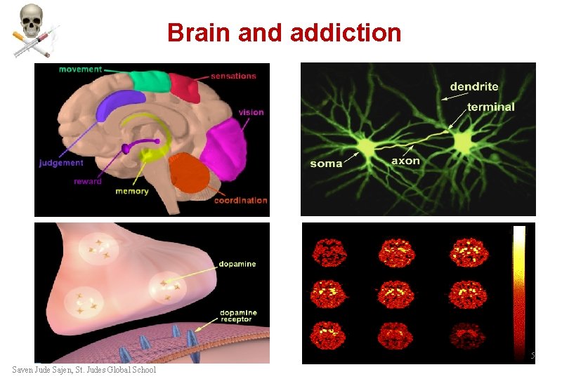 Brain and addiction 5 Saven Jude Sajen, St. Judes Global School Brain and addiction 5 Saven Jude Sajen, St. Judes Global School