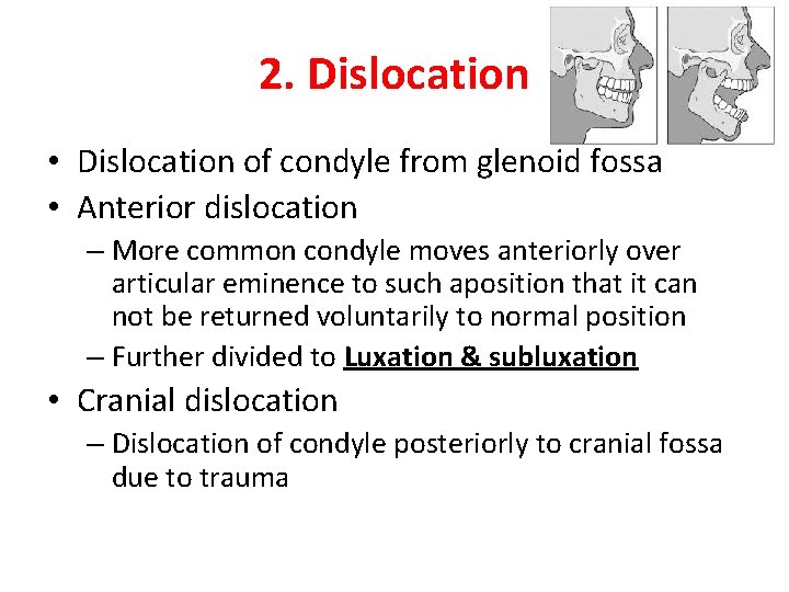 2. Dislocation • Dislocation of condyle from glenoid fossa • Anterior dislocation – More