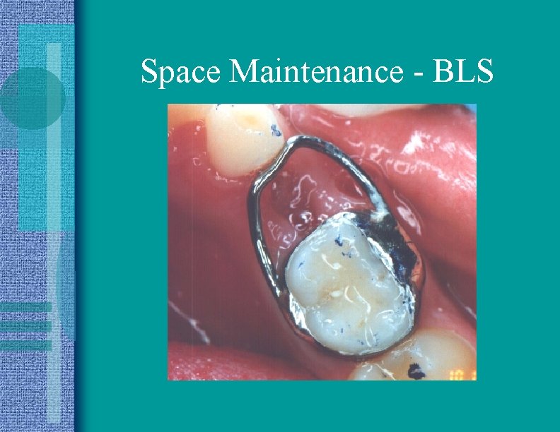 Space Maintenance - BLS 