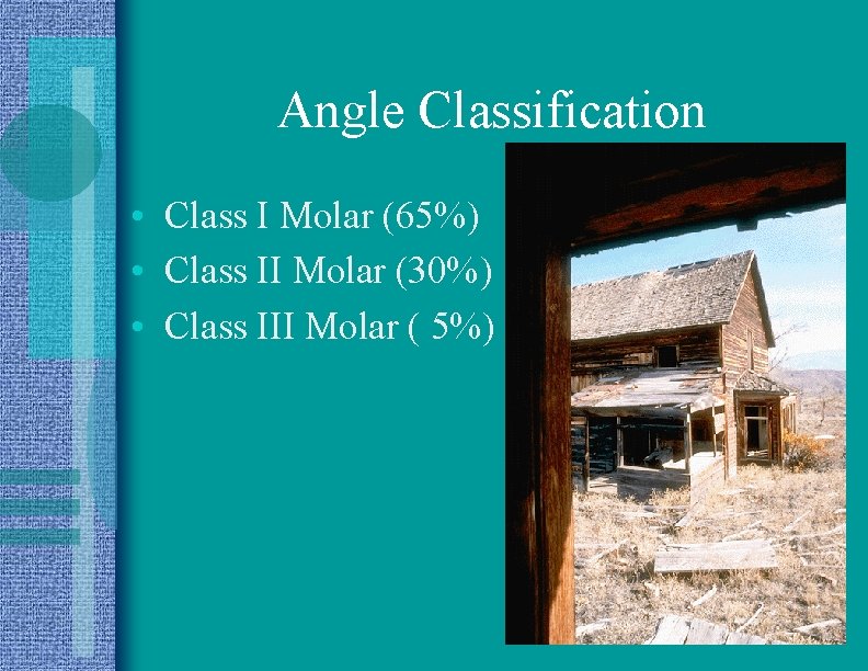 Angle Classification • Class I Molar (65%) • Class II Molar (30%) • Class