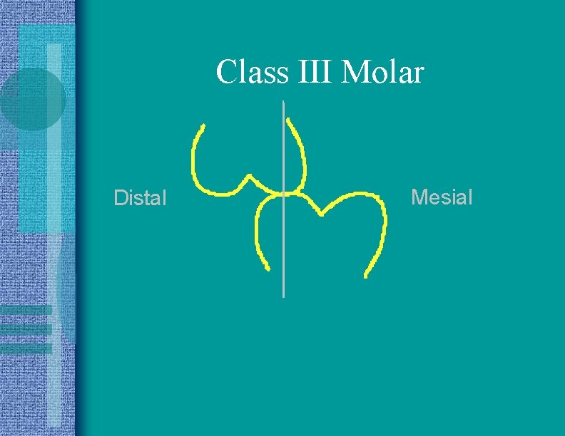 Class III Molar Distal Mesial 