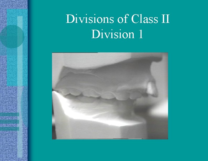 Divisions of Class II Division 1 