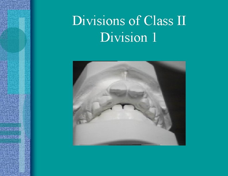 Divisions of Class II Division 1 