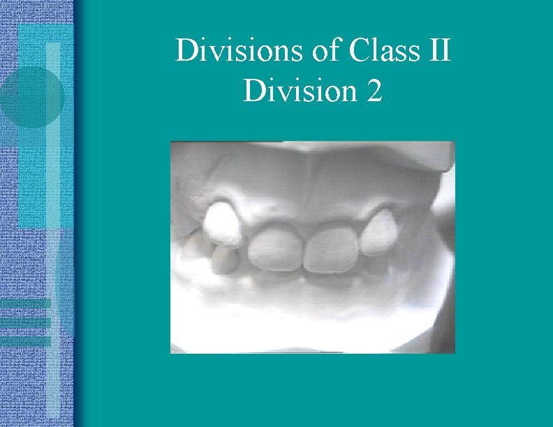 Divisions of Class II Division 2 