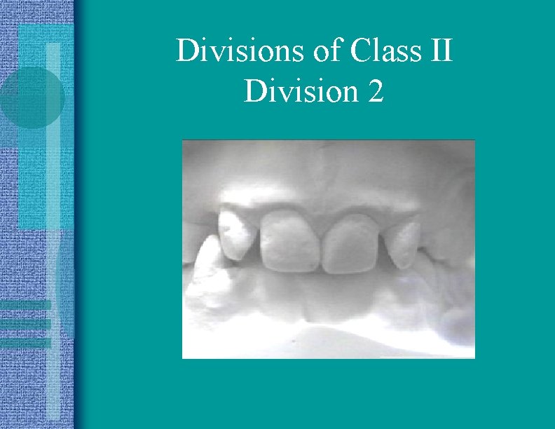 Divisions of Class II Division 2 