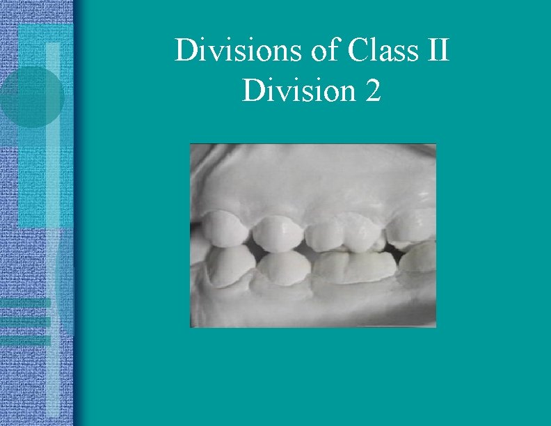 Divisions of Class II Division 2 