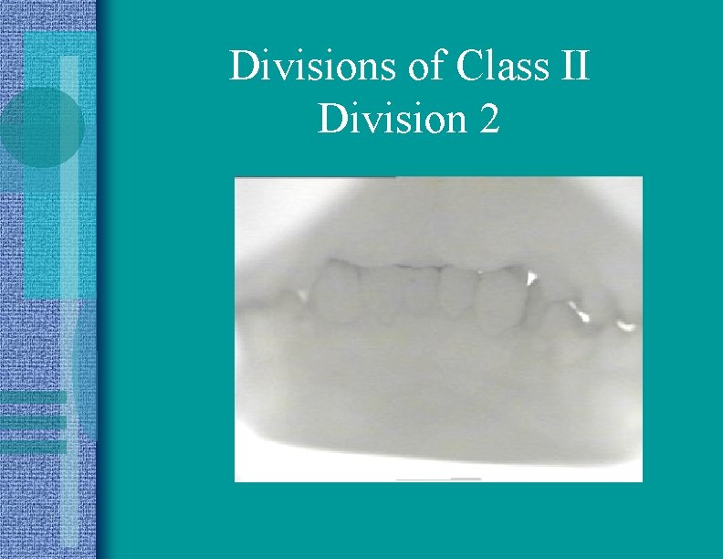 Divisions of Class II Division 2 