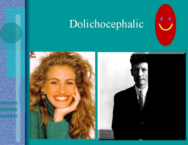 Dolichocephalic 
