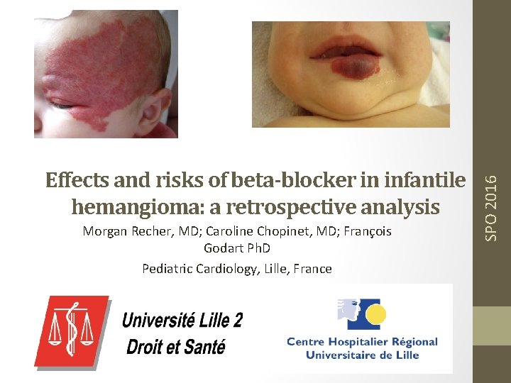 Morgan Recher, MD; Caroline Chopinet, MD; François Godart Ph. D Pediatric Cardiology, Lille, France