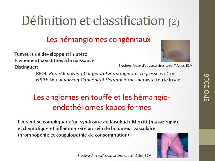 Définition et classification (2) Tumeurs de développant in utéro Pleinement constitués à la naissance