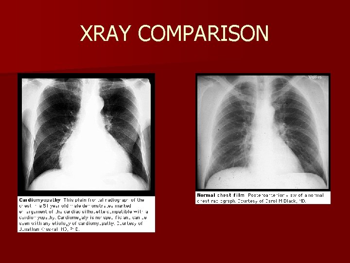 XRAY COMPARISON 