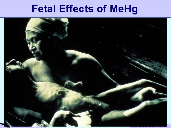 Fetal Effects of Me. Hg A Small Dose of Toxicology Small Dose of Mercury