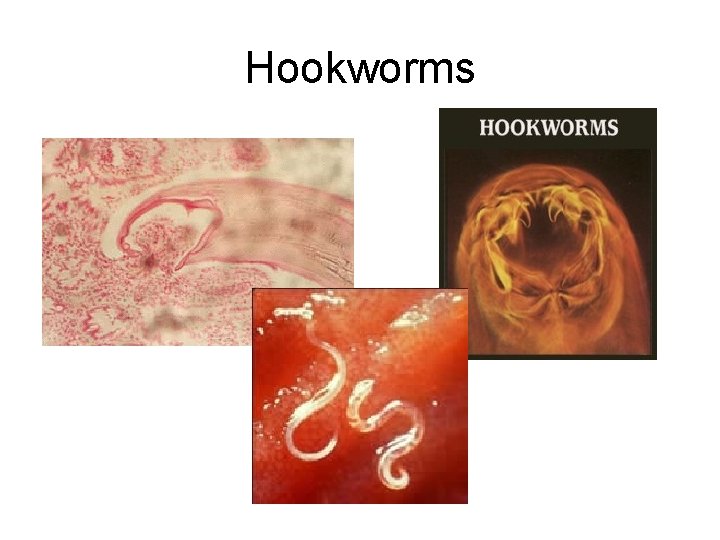 Hookworms 