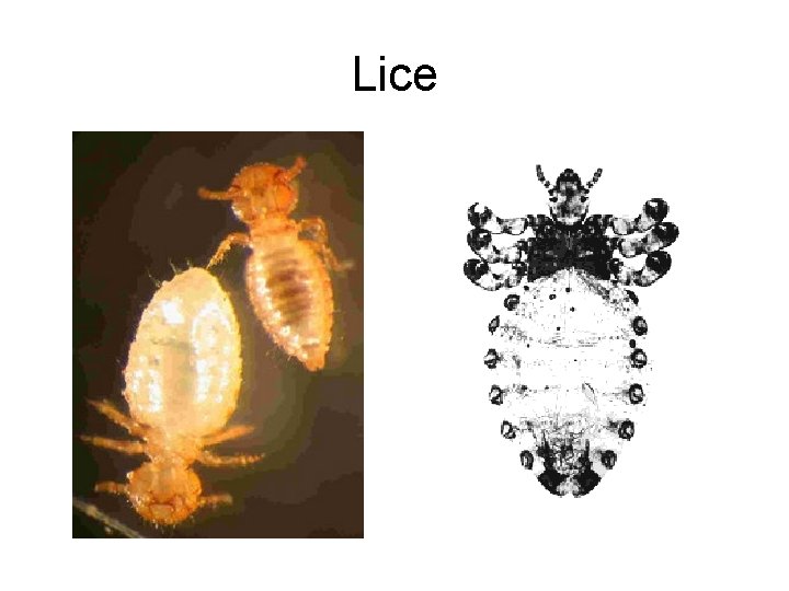 Lice 