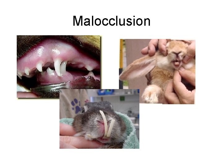Malocclusion 
