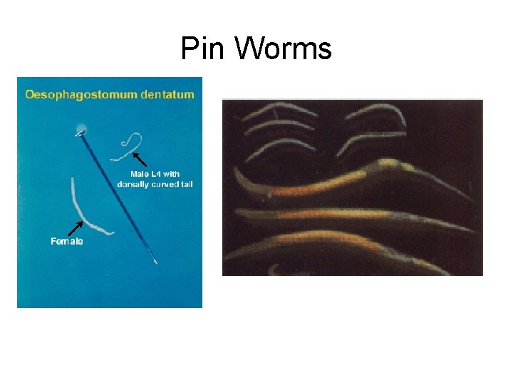 Pin Worms 