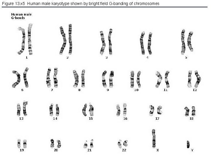 Figure 13. x 5 Human male karyotype shown by bright field G-banding of chromosomes