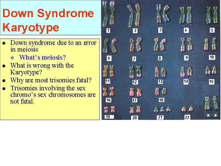 Down Syndrome Karyotype l l Down syndrome due to an error in meiosis l