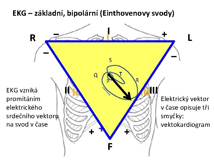 EKG – základní, bipolární (Einthovenovy svody) I – R – II T R P