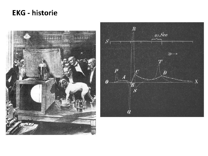 EKG - historie 