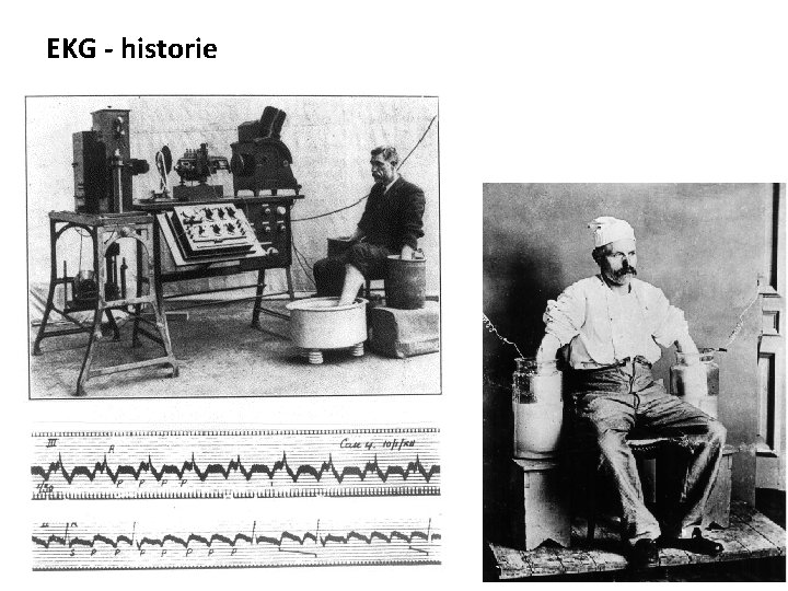 EKG - historie 