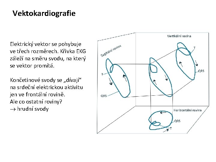 Vektokardiografie Elektrický vektor se pohybuje ve třech rozměrech. Křivka EKG záleží na směru svodu,